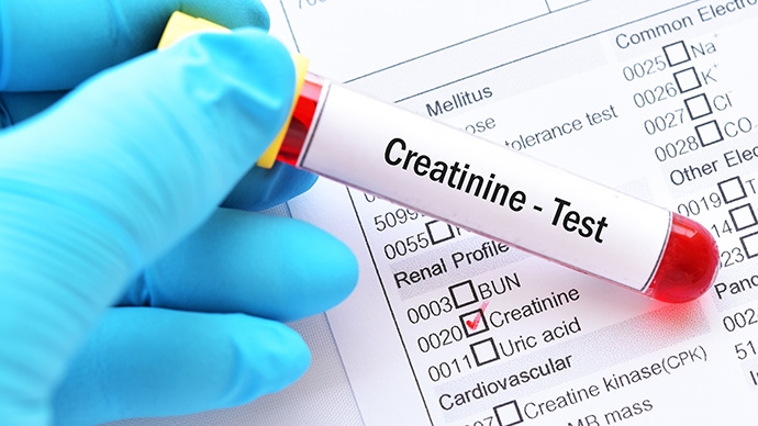 腎功能檢查指南-慢性腎病早期無徵狀-10大指標-高危族健康建議